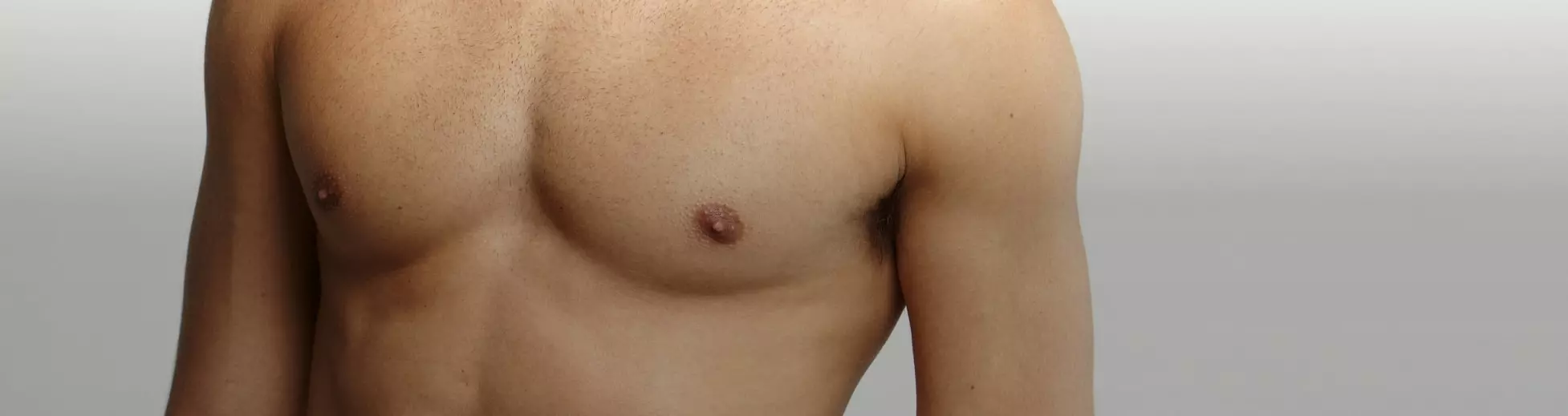 Illustrative image representing Gynecomastia Surgery at Novelle Aesthetics