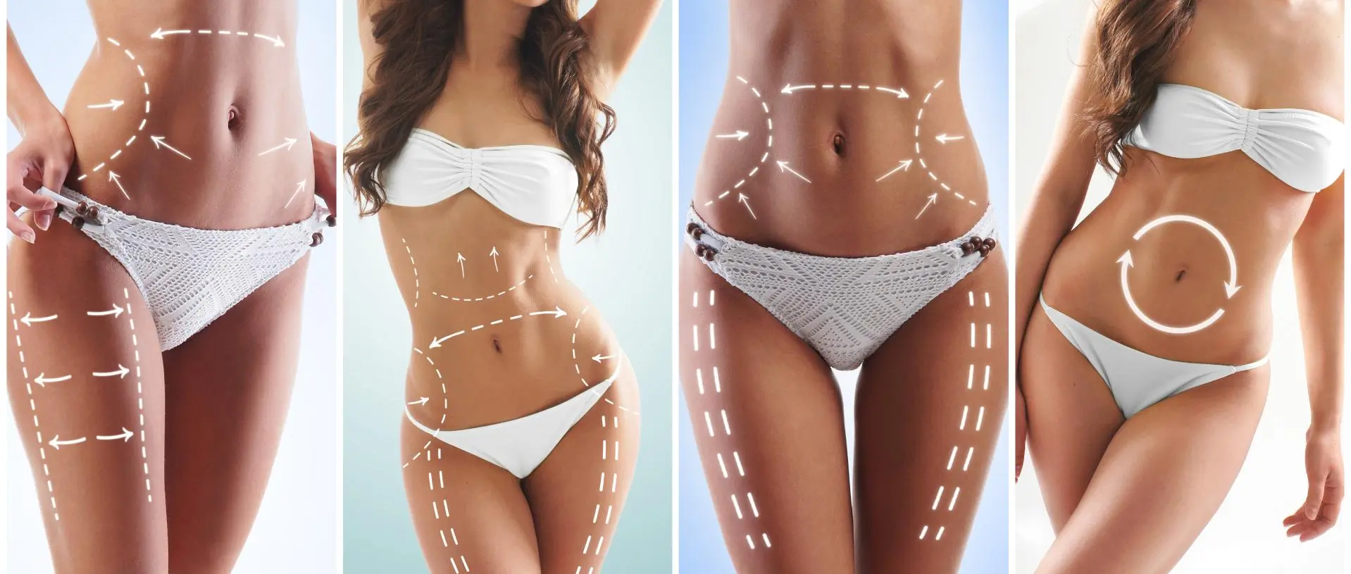 Illustrative image representing Liposuction (360° VASER) at Novelle Aesthetics