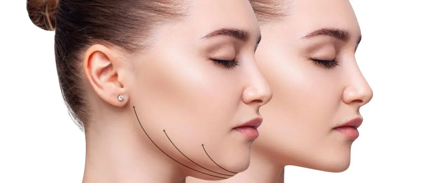 Illustrative image representing Neck Lift (Platysmaplasty) at Novelle Aesthetics